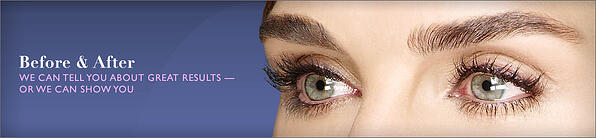 Latisse eyelash enhancement