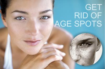 how to get rid of age spots 