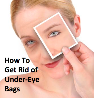 7 Ways to Get Rid of Under Eye Bags - Millennial Plastic Surgery