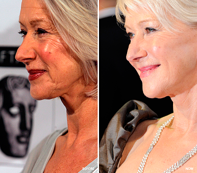 helen mirren before and after