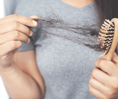 Female Hair Loss-2